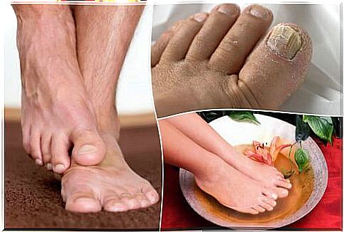 Fungus of nails and skin - 7 home remedies