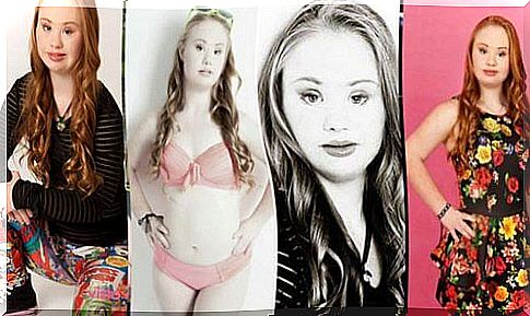 The model with Down syndrome triumphs in the USA!