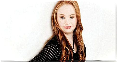 A model with Down syndrome