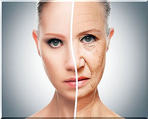 Skin aging