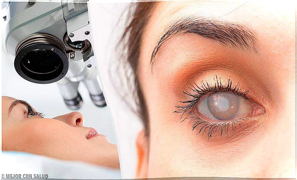 Cataract treatment - its symptoms and treatment methods