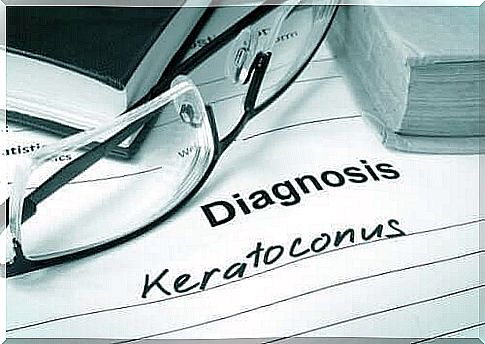 Keratoconus - characteristics and treatment