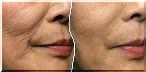 Reduce wrinkles with facial firming exercises