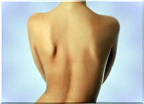 Scoliosis is the source of back pain