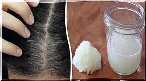 Hair Loss - Onion and Honey Remedies