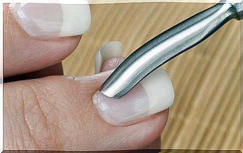 Nails - neglected cuticles