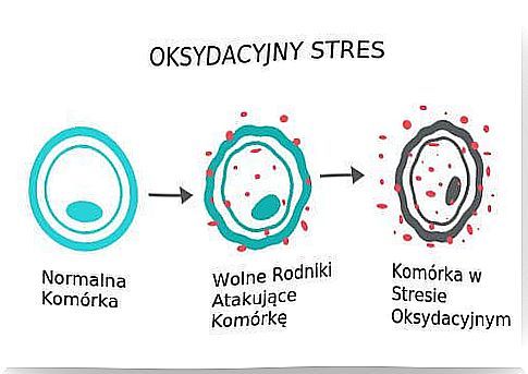 Oxidative stress