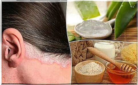 Remedy for psoriasis