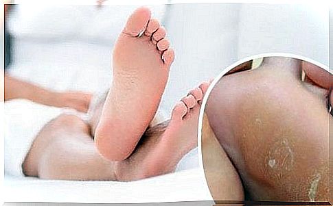 Remove corns on your feet in an effective way