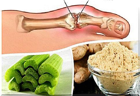 Too Much Uric Acid?  - Natural remedy